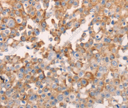 GNA11 Polyclonal Antibody - 2