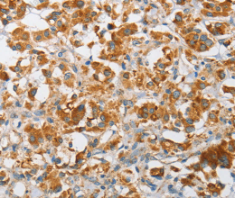 ARHGEF9 Polyclonal Antibody - 2