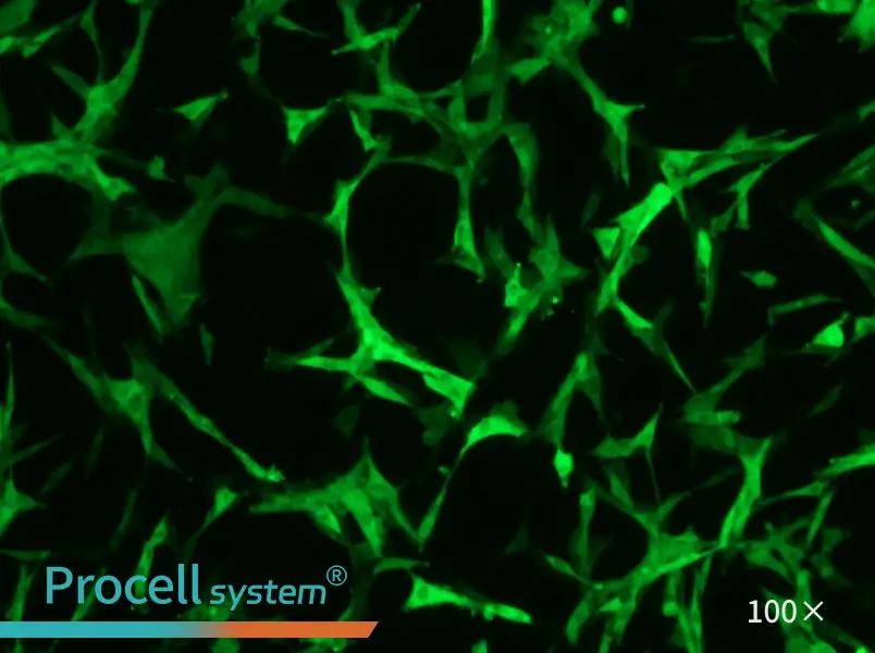 U-87 MG-GFP Cell Complete Medium - 3