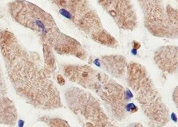 Recombinant APAF1 Monoclonal Antibody-searchlist-2