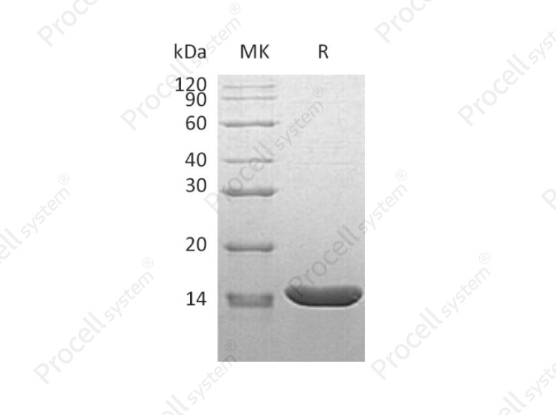 TNF-&alpha;/TNFA/TNFSF2, Mouse, Recombinant
