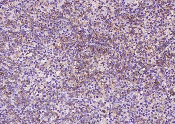 CD10 Monoclonal Antibody - 2
