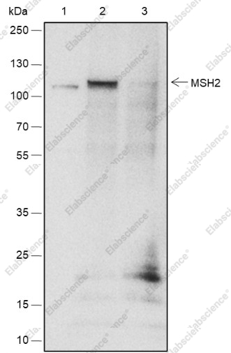Recombinant MSH2 Monoclonal Antibody - 5