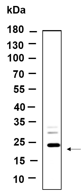 Recombinant LHFPL5 Monoclonal Antibody-searchlist-1