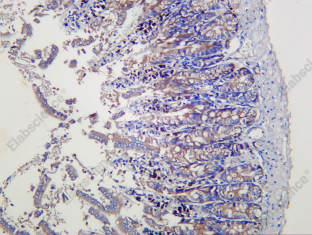 Recombinant EFP Monoclonal Antibody - 2