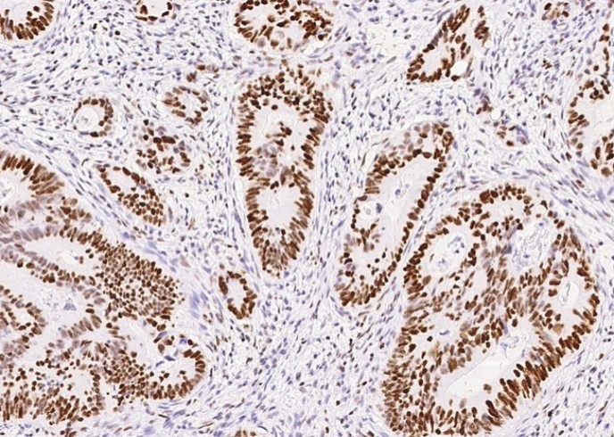 Recombinant MSH6/GTBP Monoclonal Antibody - small - 4