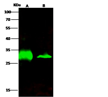 Recombinant AK2/Adenylate kinase 2 Monoclonal Antibody - small - 3