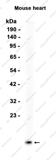 Recombinant Cardiac FABP Monoclonal Antibody - 1