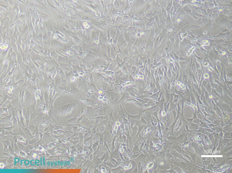 Mouse Dermal Fibroblasts (Primary cell immortalization)Mouse Dermal Fibroblasts (Primary cell immortalization) - 1