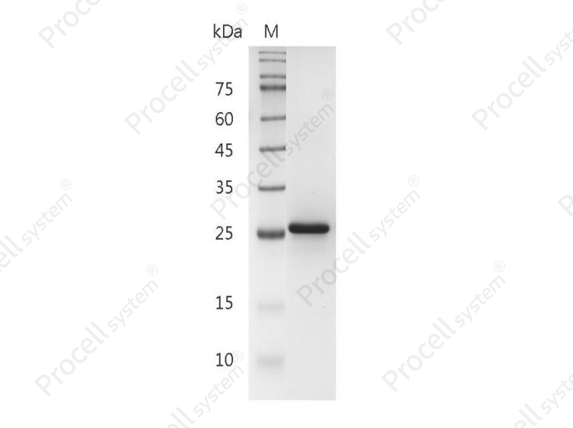 IL-34/C16orf77, Human, Recombinant