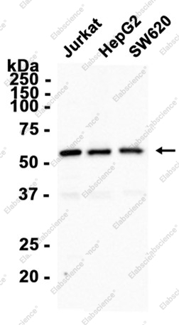 Recombinant P70 S6 Kinase beta Monoclonal Antibody - 2