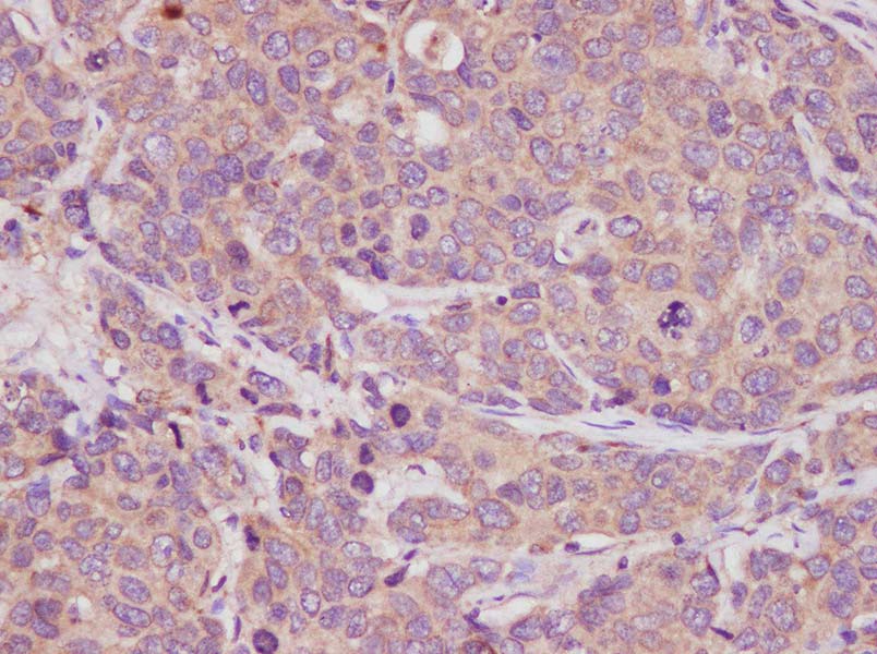 Purified Anti-Human CD354 Antibody[TREM-26]-产品推荐-1