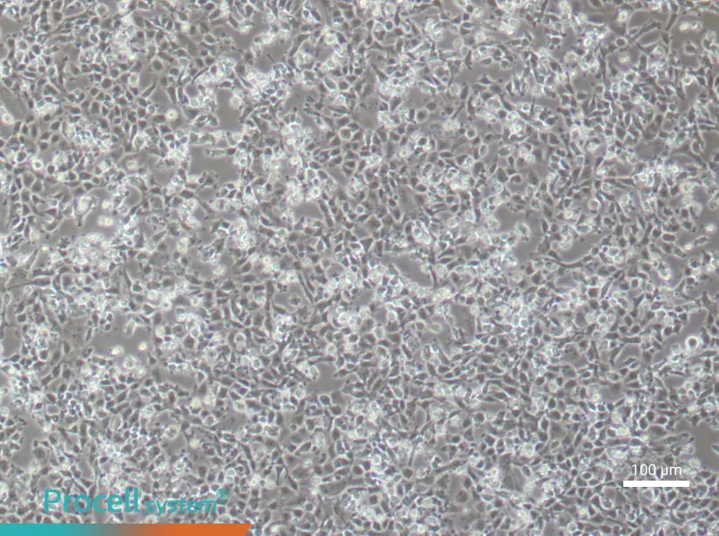Rat Aortic Endothelial (Primary cell immortalization) Cell Complete MediumRat Aortic Endothelial (Primary cell immortalization) Cell Complete Medium - 1