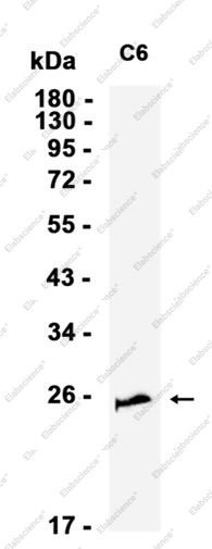 Recombinant Casein Kinase 2 beta Monoclonal Antibody - 2