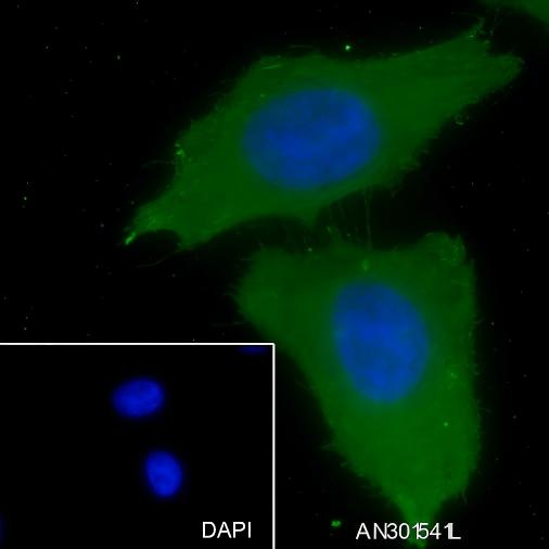 Recombinant GRK2 Monoclonal Antibody - 2