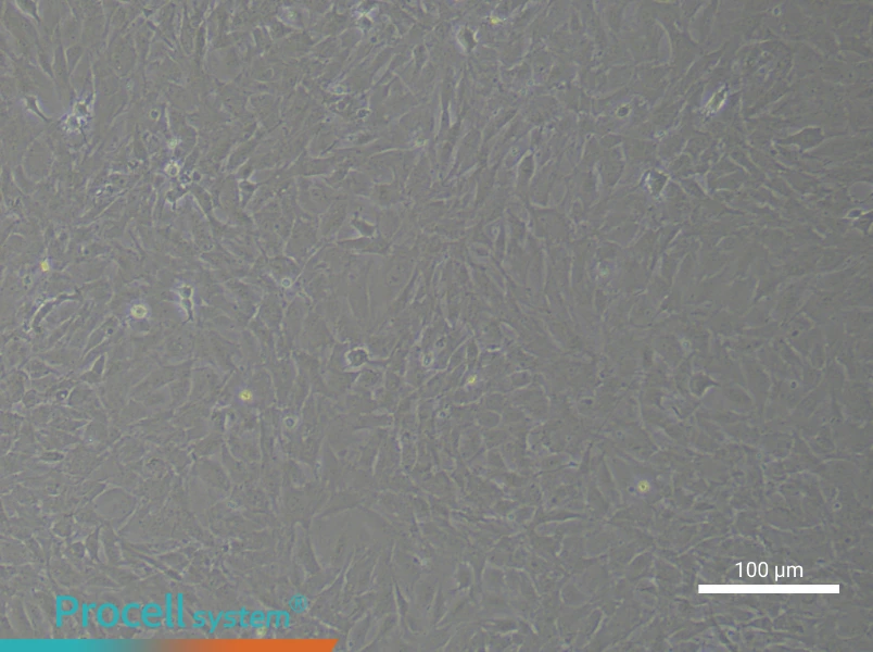 Rat Aortic Adventitial Fibroblast Complete Medium - 1