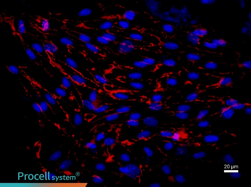 Mouse Pulmonary Great Artery Endothelial Cell Complete Medium - 2