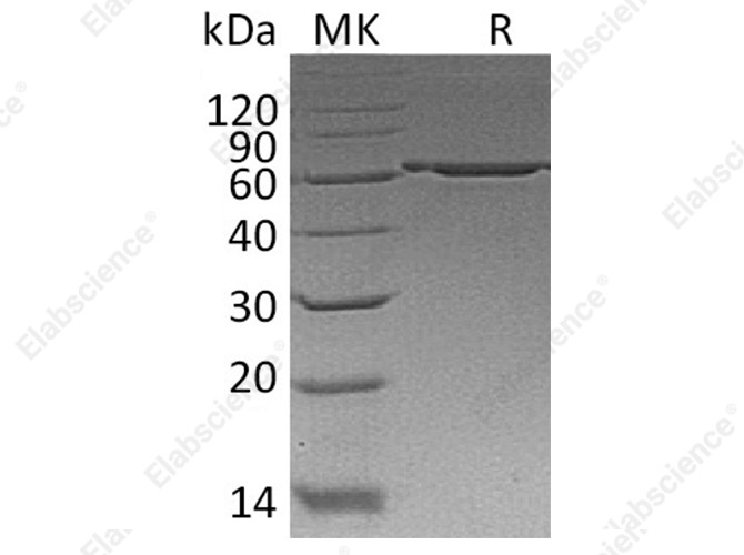 Recombinant Human P4HB Protein (His Tag) - 1