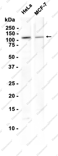 Recombinant RNF20 Monoclonal Antibody - 2