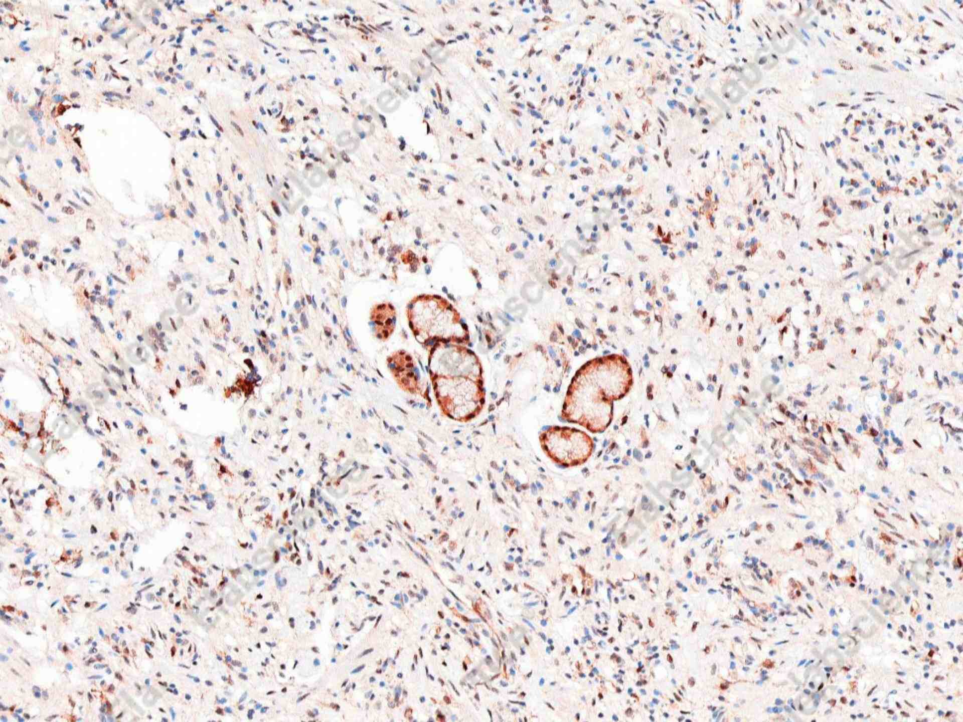 Recombinant SQSTM1/p62 Monoclonal Antibody - 1