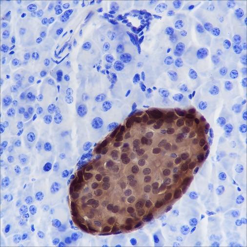 Recombinant SCGN Monoclonal Antibody - 2