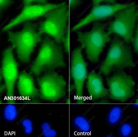 Recombinant PPP1CB Monoclonal Antibody - 3