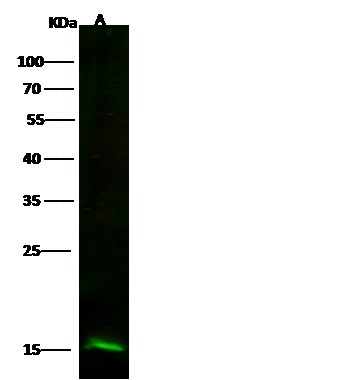 Recombinant Profilin 2/PFN2 Monoclonal Antibody - small - 1