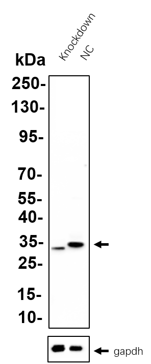 Recombinant NQO1 Monoclonal Antibody - 3
