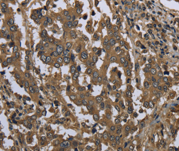 GOLGA2 Polyclonal Antibody - 2
