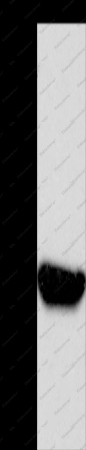 BABAM2 Polyclonal Antibody - 1
