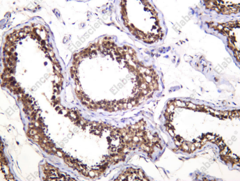 Recombinant ID4 Monoclonal Antibody - 2