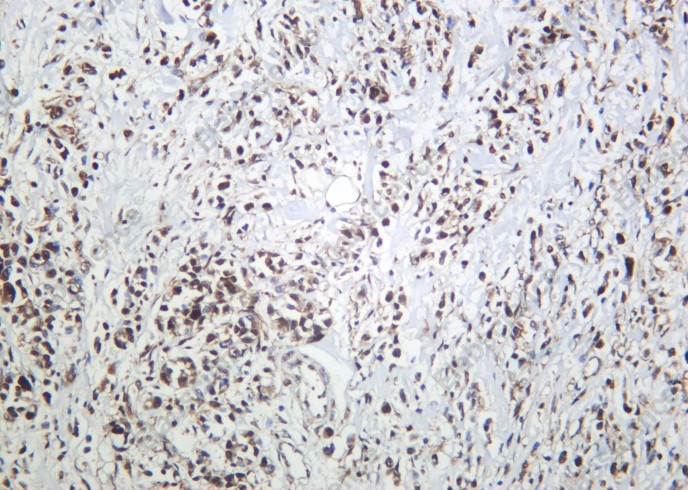 Recombinant ATP-Citrate Lyase Monoclonal Antibody - 2