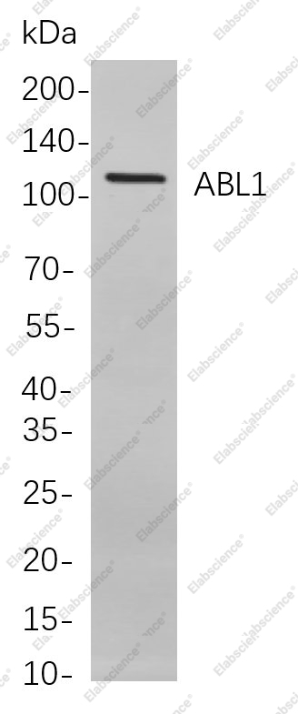 Recombinant ABL1 Monoclonal Antibody - 1