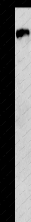 c-Fms Polyclonal Antibody - 1