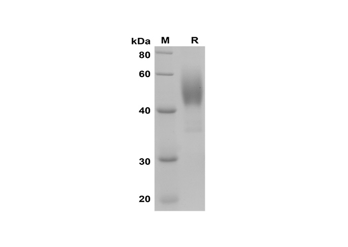 Recombinant Mouse DPPIV/CD26 Protein(Fc Tag)-产品推荐-1