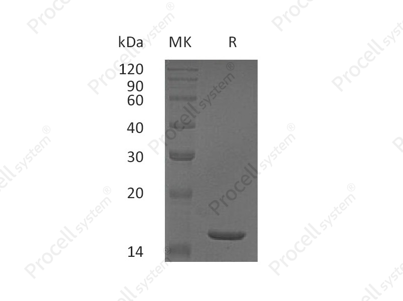 TNF-&alpha;/ TNFA/ TNFSF2, Human, Recombinant