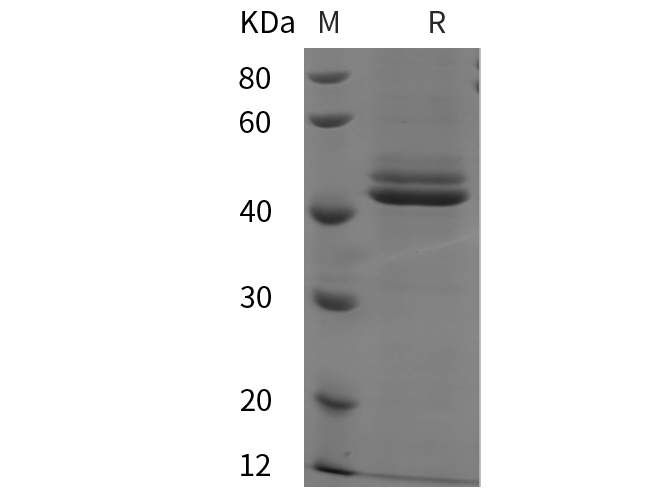 Recombinant Human CD40 Protein(His Tag)-产品推荐-1