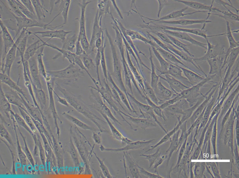 Human Skeletal Muscle Fibroblast Complete Medium - 6