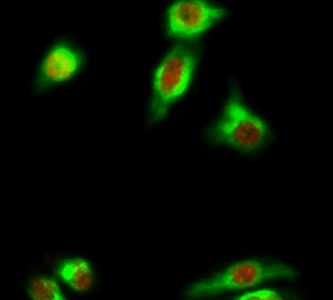 Recombinant LC3B Monoclonal Antibody - small - 6