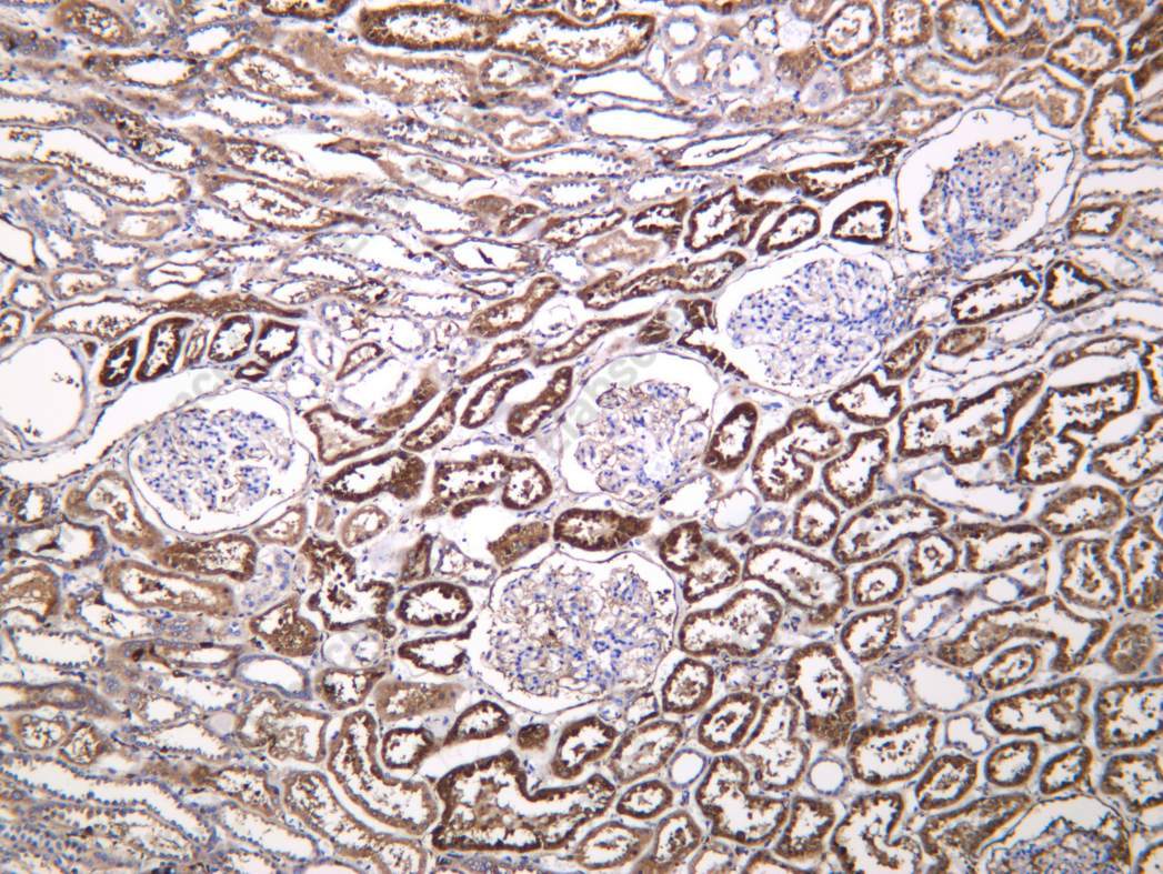 Recombinant LGMN Monoclonal Antibody - 1