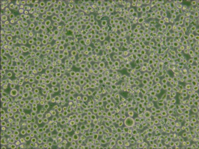 U266 [U266B1] Cell Complete Medium - small - 5