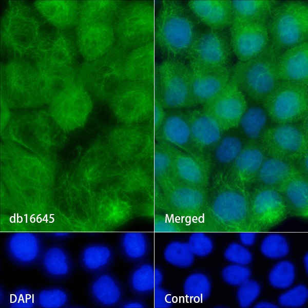 Recombinant KRT14/Cytokeratin 14 Monoclonal Antibody - 2
