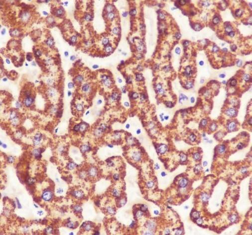 Recombinant CPS1 Monoclonal Antibody - small - 4