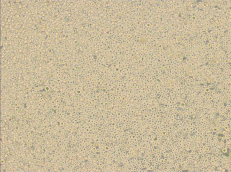 U266 [U266B1] Cell Complete Medium - 3