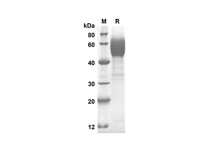 Recombinant Mouse IL-5 Protein(Fc Tag)-产品推荐-1