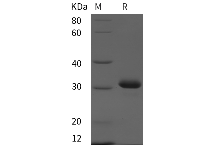 Recombinant Mouse CD8a/Lyt2 Protein(truncated) (His Tag)-产品推荐-1