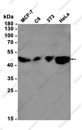Recombinant Aromatase Monoclonal Antibody - 1