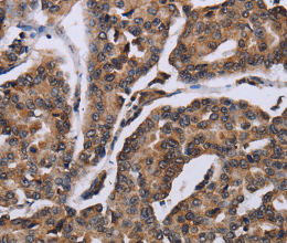 KIF1C Polyclonal Antibody - 2