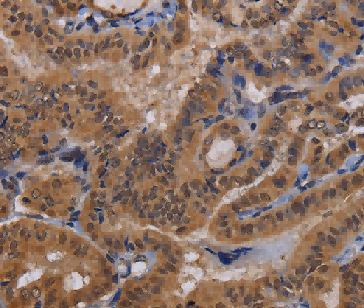 MCTS1 Polyclonal Antibody - 2