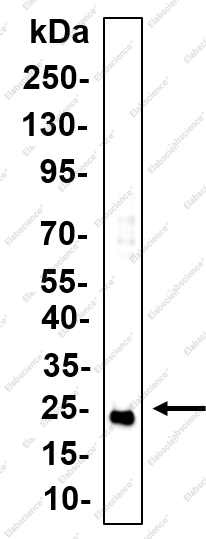 Recombinant LYPLA1 Monoclonal Antibody - 3
